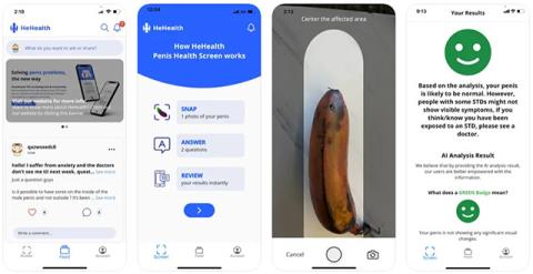 Les applications d’IA peuvent diagnostiquer les maladies sexuellement transmissibles uniquement grâce aux images